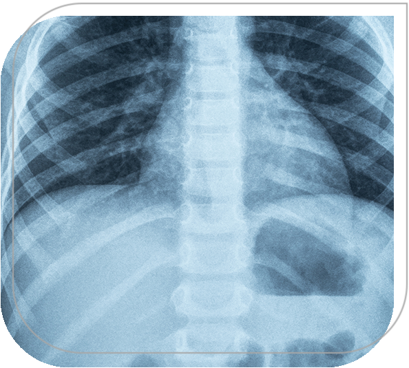 X-Ray technology | Exosens