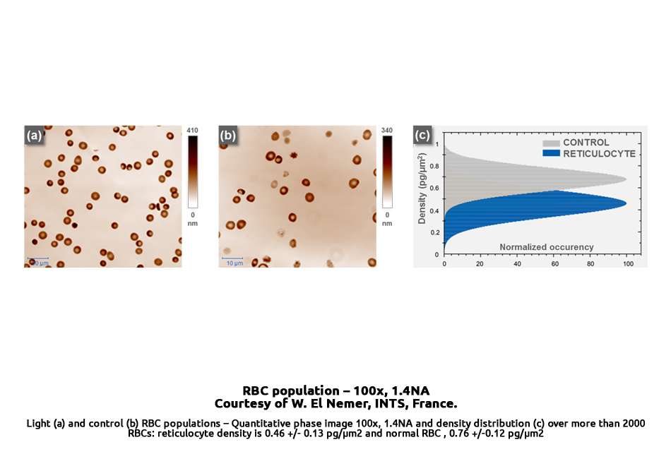 blood_testing_-_RBC_population_-reticulo