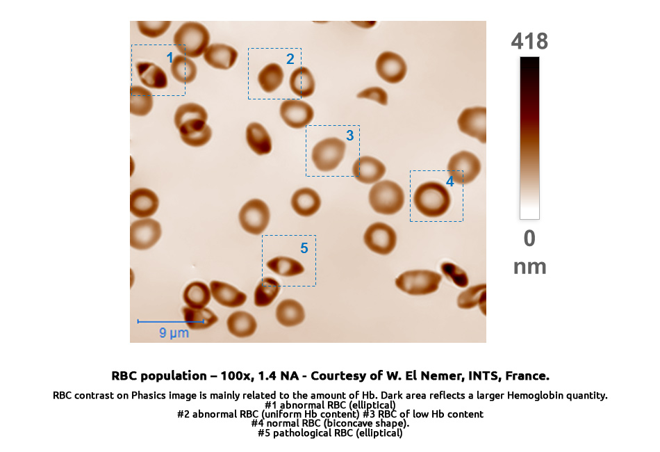 blood_testing_-_RBC_population_1