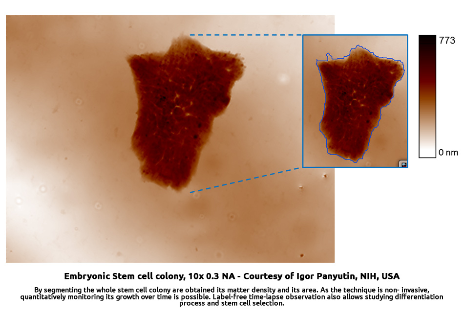 microbio-stemcells_ThTeqmS