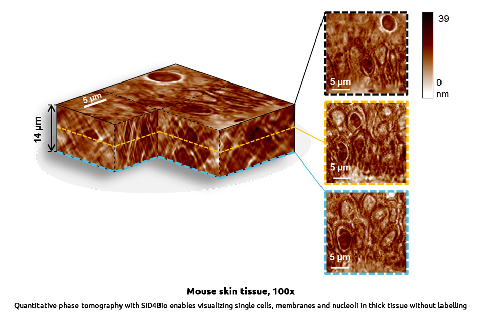 quantitative-phase-tomography-mouseskin